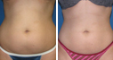 Before & After Photos